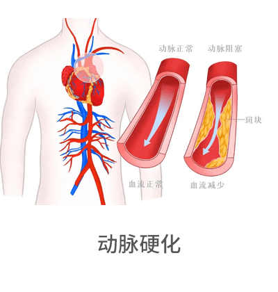 動脈硬化檢測儀